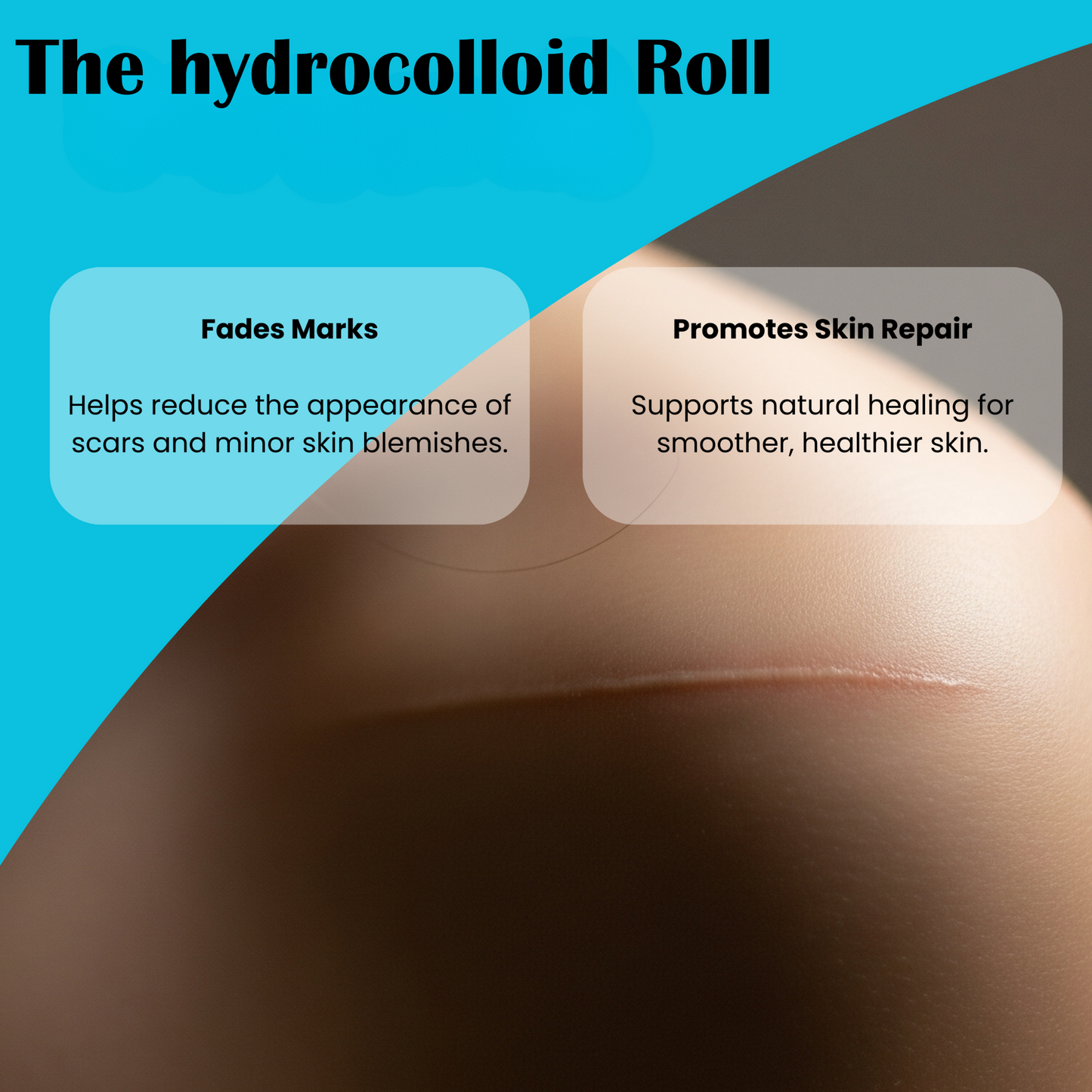The Hydrocolloid Healing Roll