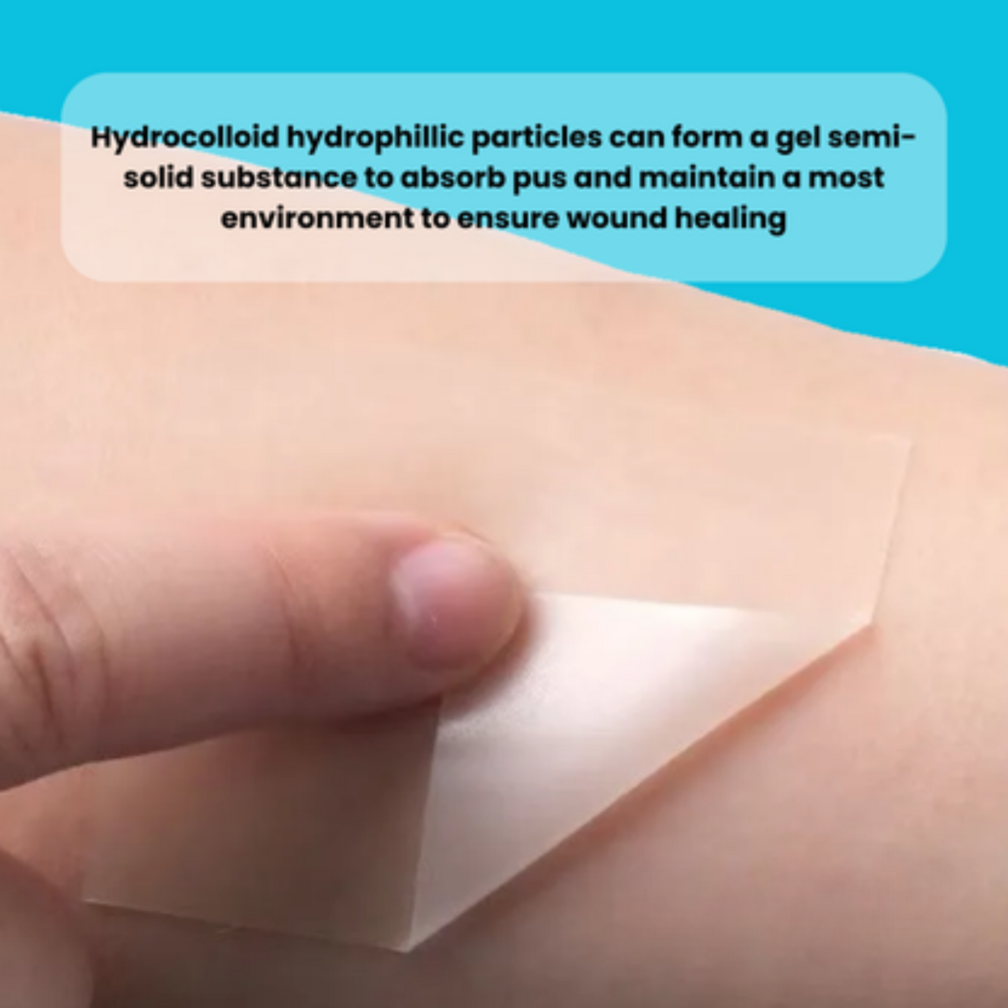 The Hydrocolloid Healing Roll